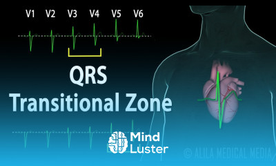 Understanding ECG EKG QRS Transitional Zone and R Wave Progression Explained Animation
