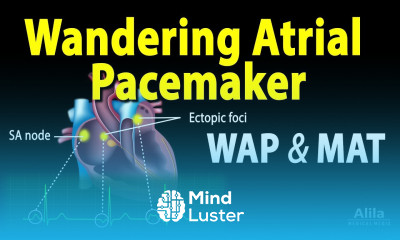Wandering Atrial Pacemaker WAP Multifocal Atrial Tachycardia MAT