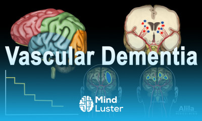 Vascular Dementia Pathology Animation