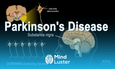 Parkinson s Disease Animation