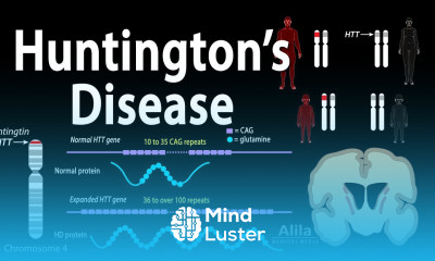 Huntington s Disease Genetics Pathology and Symptoms Animation