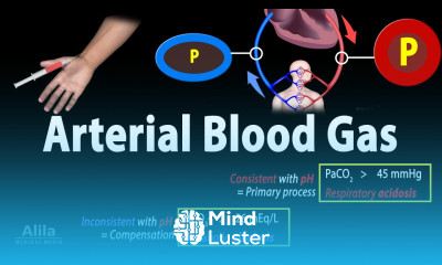 Arterial Blood Gas ABG Test Animation