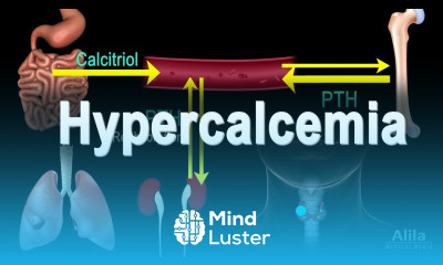 Hypercalcemia Too Much Calcium Animation
