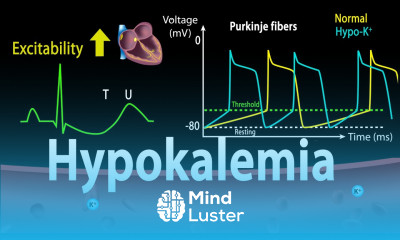 Hypokalemia Causes Symptoms Effects on the Heart Pathophysiology Animation
