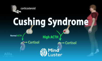 Cushing Syndrome Animation