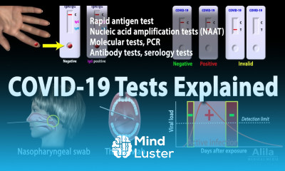 Understanding Different COVID 19 Tests Animation