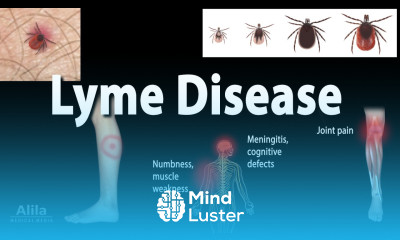 Lyme Disease Animation