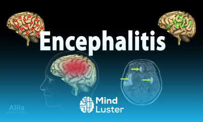 Encephalitis Animation