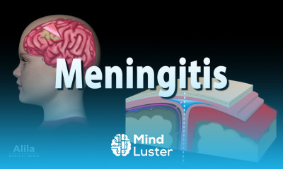 Meningitis Pathology Causes Symptoms Diagnosis and Treatment Animation