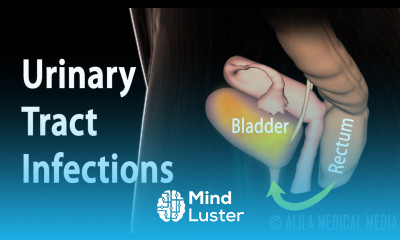 Urinary Tract Infections Animation