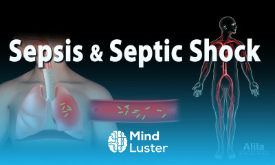 Sepsis and Septic Shock Animation