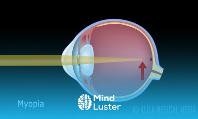 Eye Anatomy and Common Defects Animated Simple Tutorial