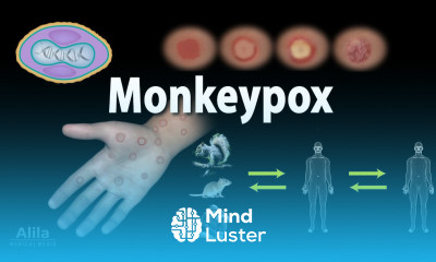 Monkeypox Symptoms Transmission Prevention and Treatments Animation