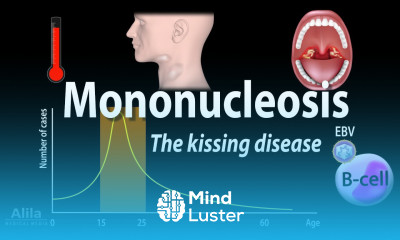 Infectious Mononucleosis Mono the Kissing Disease Animation