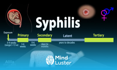 Syphilis Pathophysiology Diagnosis and Treatments Animation