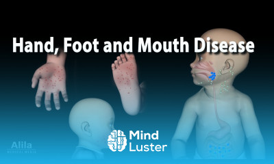 Hand Foot and Mouth Disease Animation
