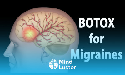 BOTOX for Migraines Animation