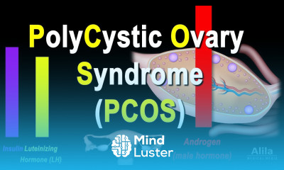 Polycystic Ovary Syndrome PCOS Pathology and Treatment Animation