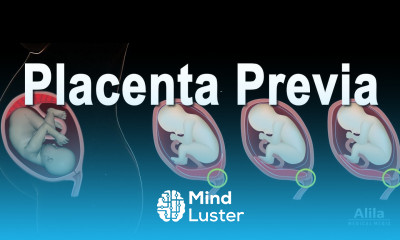 Low Lying Placenta Placenta Previa Animation