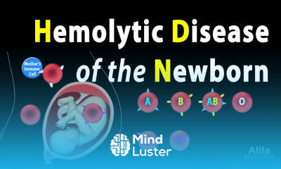 Hemolytic Disease of the Newborn HDN Animation
