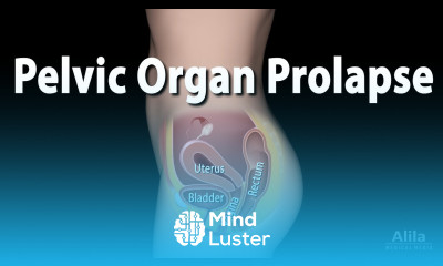Pelvic Organ Prolapse Animation