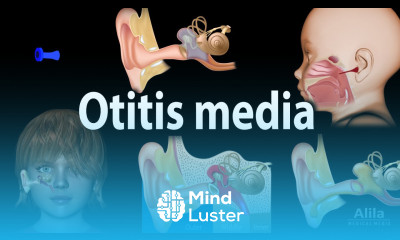 Otitis Media Anatomy Pathophysiology Risk Factors Types of OM Symptoms and Treatment Animation