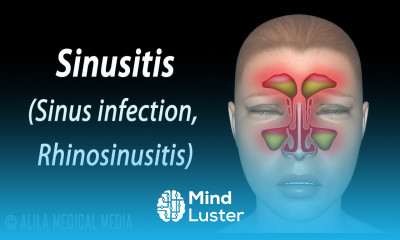 Sinusitis Animation