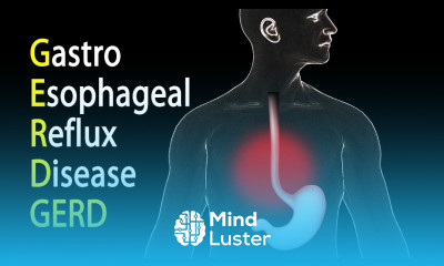 GERD Gastroesophageal Reflux Disease or Gastric Reflux Animation