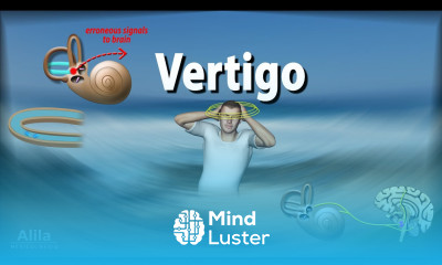 Vertigo Causes Pathophysiology and Treatments Animation