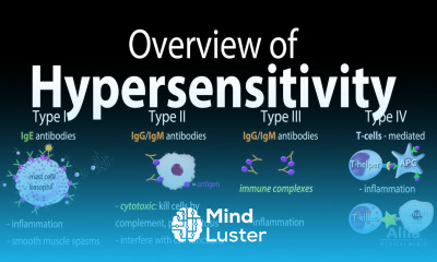 Hypersensitivity Overview of the 4 Types Animation