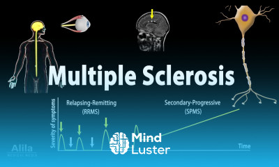 Multiple Sclerosis Animation