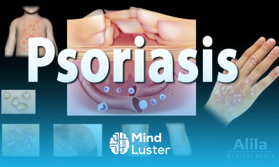 Psoriasis Types Symptoms Causes Pathology and Treatment Animation