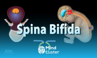 Spina Bifida Animation