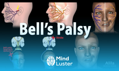 Bell s Palsy Pathophysiology Symptoms Diagnosis and Treatment Animation