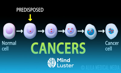 Cancer How Cancer Starts How Cancer Spreads Where and Why Animation