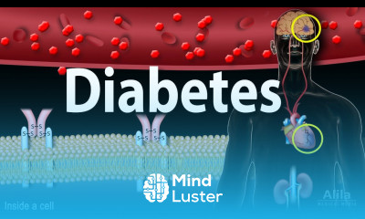 Diabetes mellitus Symptoms Complication Pathology of Type 1 and Type 2 Animation