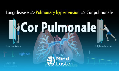 Cor Pulmonale Animation