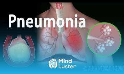 Pneumonia Animation