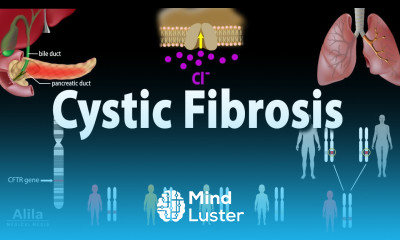 Cystic Fibrosis Pathophysiology Genetics Symptoms Diagnosis and Treatments Animation