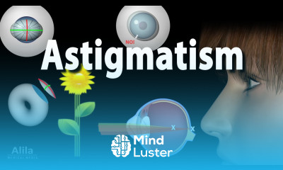 Astigmatism Types Causes Symptoms and Treatment Options Animation