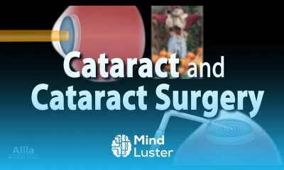 Cataract and Cataract Surgery Animation
