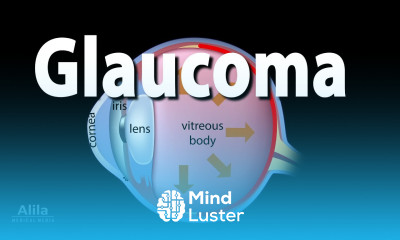 Development of Glaucoma Animation Open Angle vs Angle Closure Glaucoma