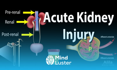 Acute Kidney Injury a k a Acute Renal Failure Animation