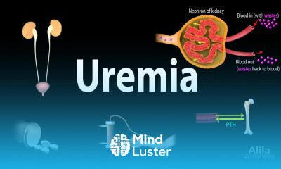Uremia Pathophysiology Symptoms Diagnosis and Treatment Animation