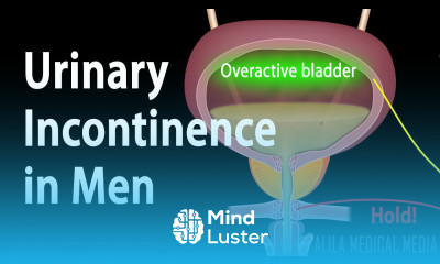 Urinary Incontinence in Men Animation