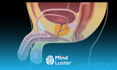 Benign Prostatic Hyperplasia BPH and Treatments animation