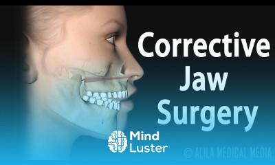 Corrective Jaw Orthognathic Surgery Animation