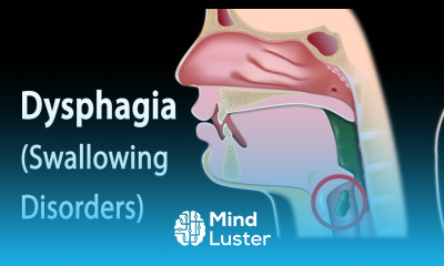 Dysphagia Animation