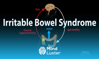 Irritable Bowel Syndrome Pathophysiology Symptoms Causes Diagnosis and Treatment Animation