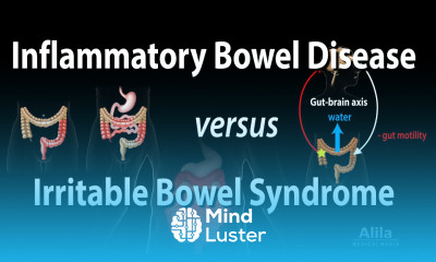 Inflammatory Bowel Disease vs Irritable Bowel Syndrome Animation